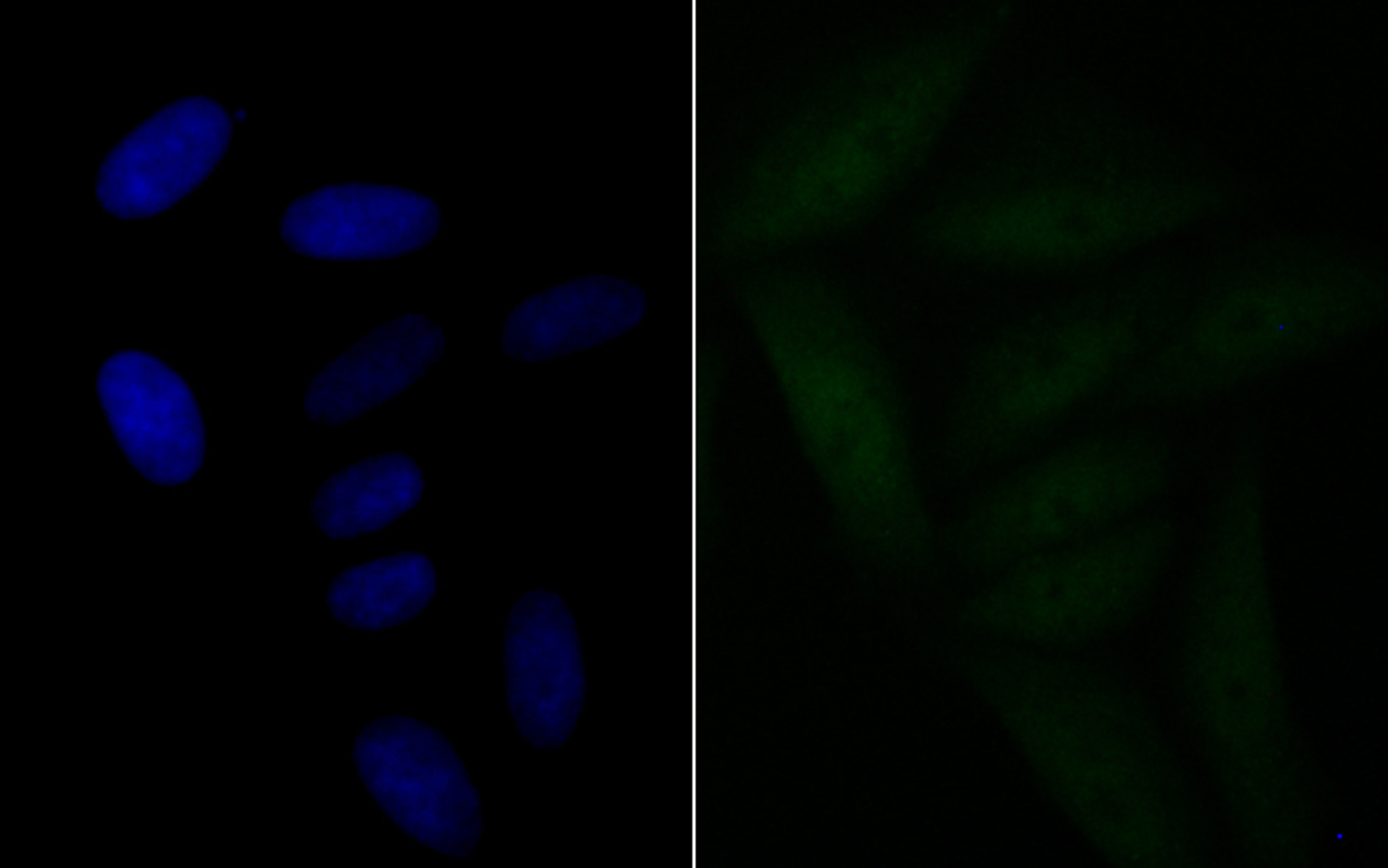 BRD2 Rabbit mAb