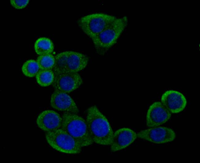 IMPDH2 Rabbit mAb