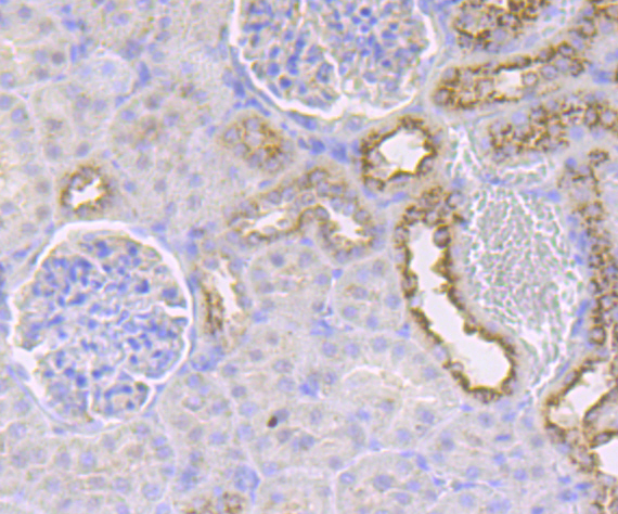 IMPDH2 Rabbit mAb