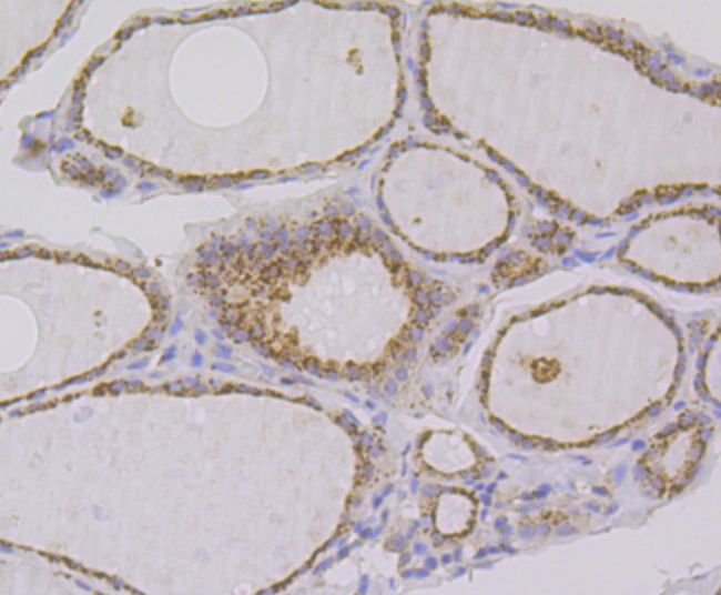 IMPDH2 Rabbit mAb
