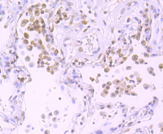 Exportin-5 Rabbit mAb