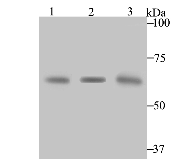 CBS Rabbit mAb