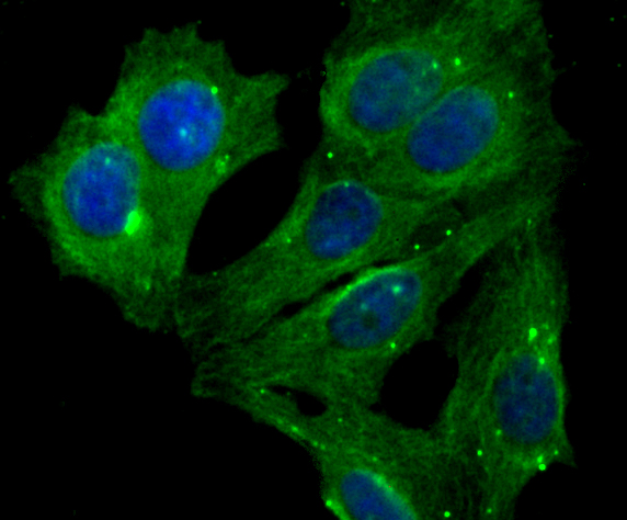 Lumican Rabbit mAb