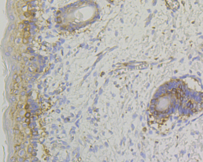 Lumican Rabbit mAb