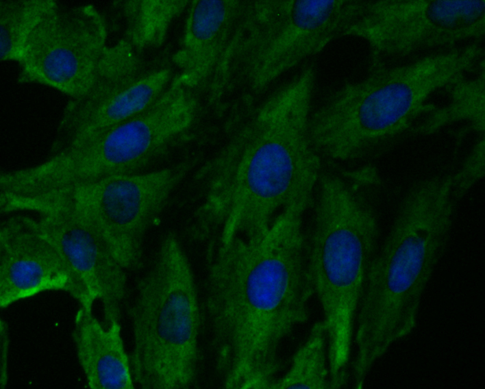 Fbx32 Rabbit mAb