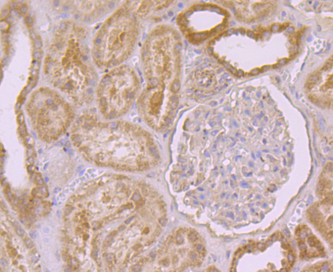 PEN2 Rabbit mAb