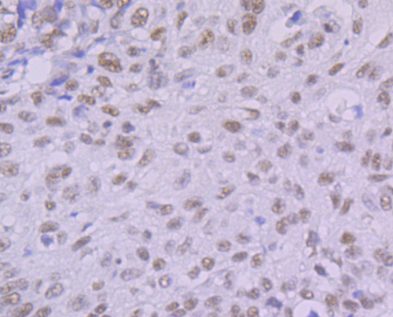 KHSRP Rabbit mAb