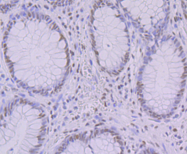 KHSRP Rabbit mAb