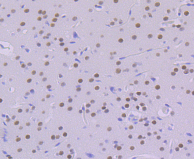 KHSRP Rabbit mAb
