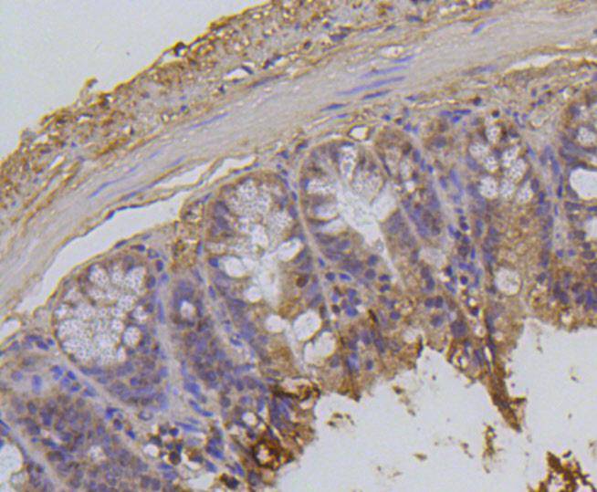 Histone H2A(acetyl K9) Rabbit mAb