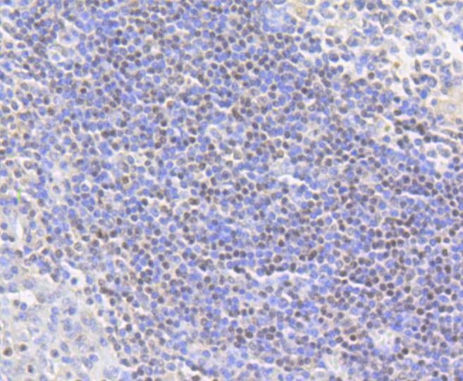 Histone H2A(acetyl K9) Rabbit mAb