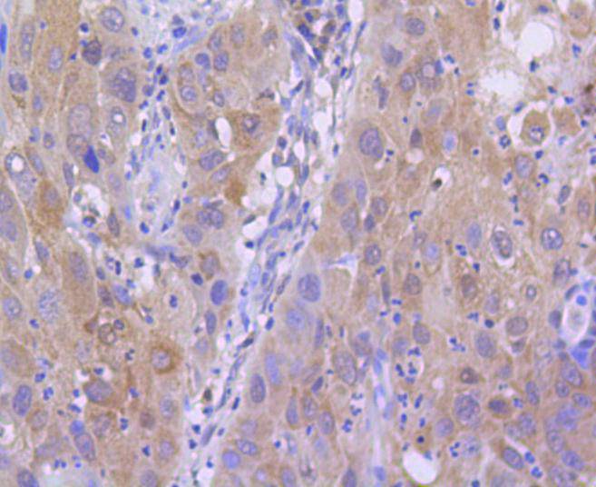 Histone H2A(acetyl K9) Rabbit mAb