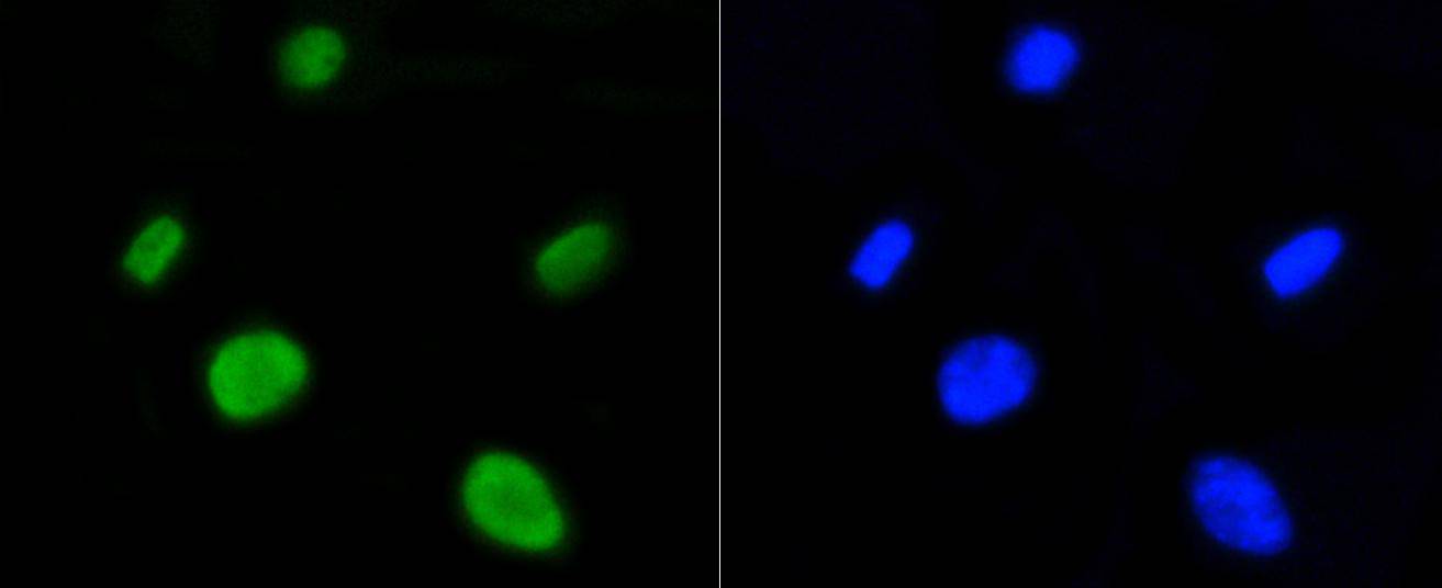 Histone H4(acetyl K5) Rabbit mAb