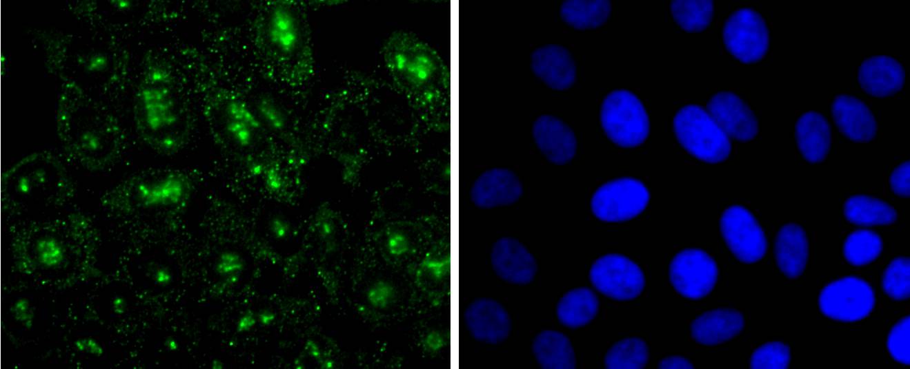Histone H3 (mono methyl R2) Rabbit mAb