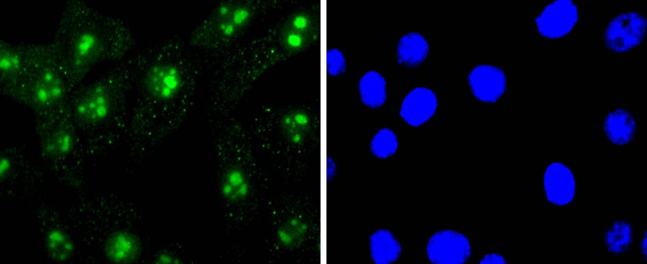 Histone H3 (mono methyl R2) Rabbit mAb