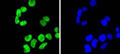 Histone H3(di methyl K9) Rabbit mAb