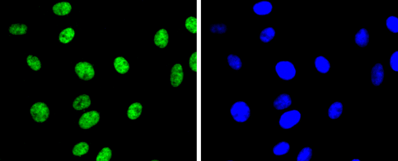 Histone H3(di methyl K9) Rabbit mAb