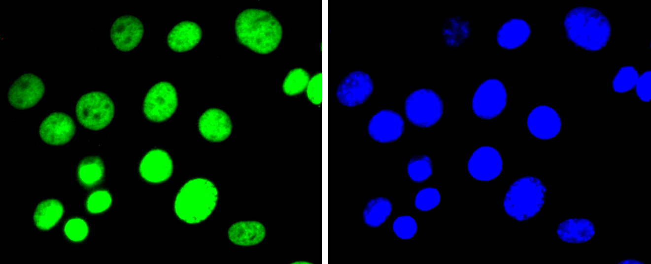 Histone H3(di methyl K9) Rabbit mAb