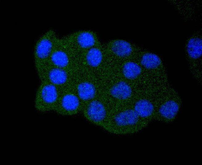 p53 (acetyl K382) Rabbit mAb