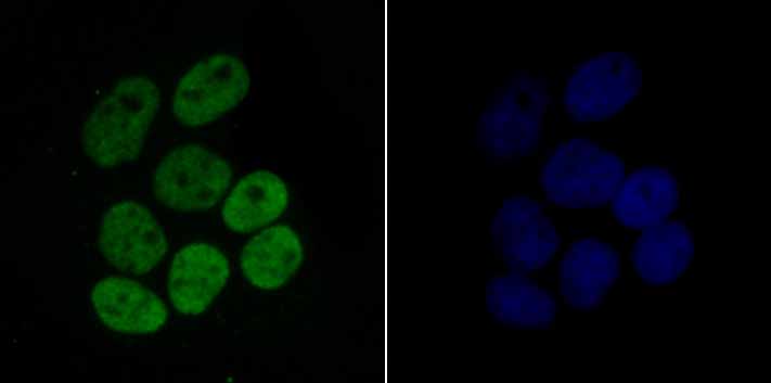 Histone H4 (acetyl K16) Rabbit mAb