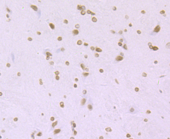 Histone H4 (acetyl K16) Rabbit mAb