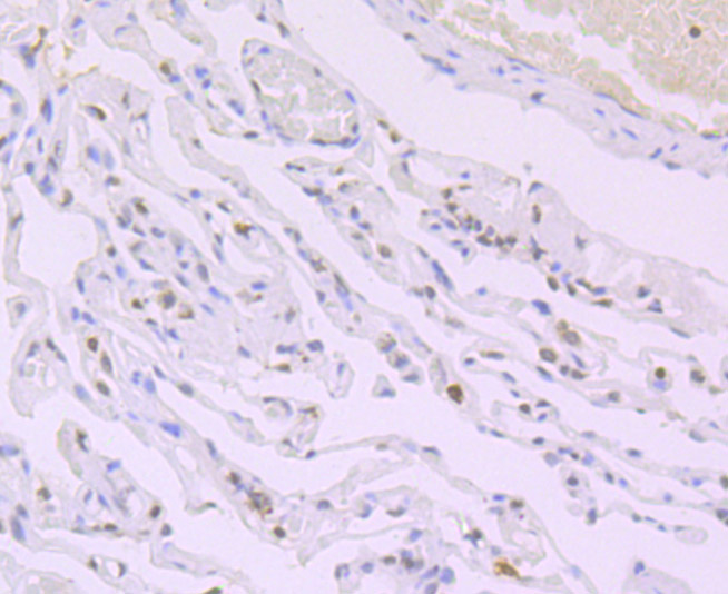 Histone H4 (acetyl K16) Rabbit mAb