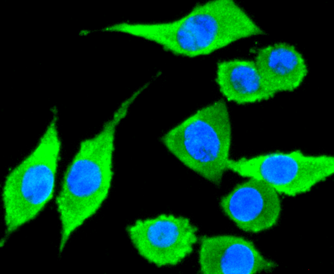TAPA1/CD81 Rabbit mAb