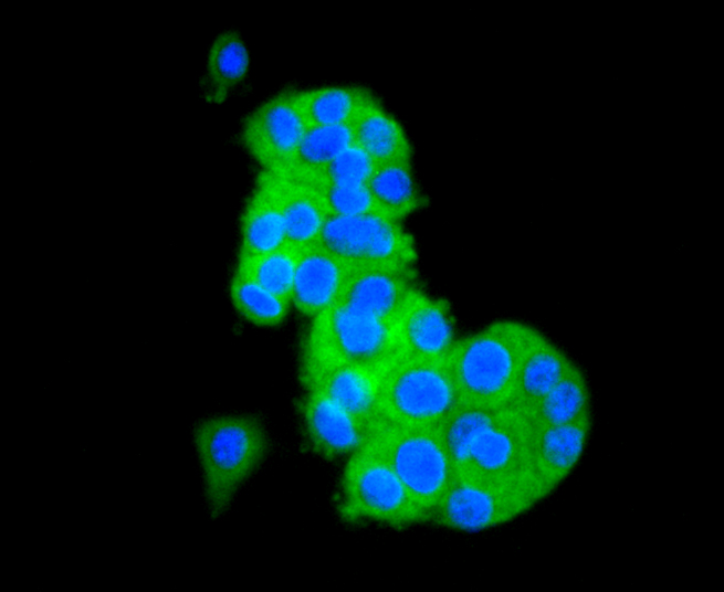 TAPA1/CD81 Rabbit mAb