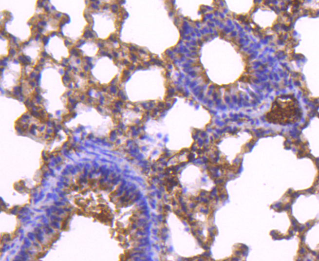 TAPA1/CD81 Rabbit mAb