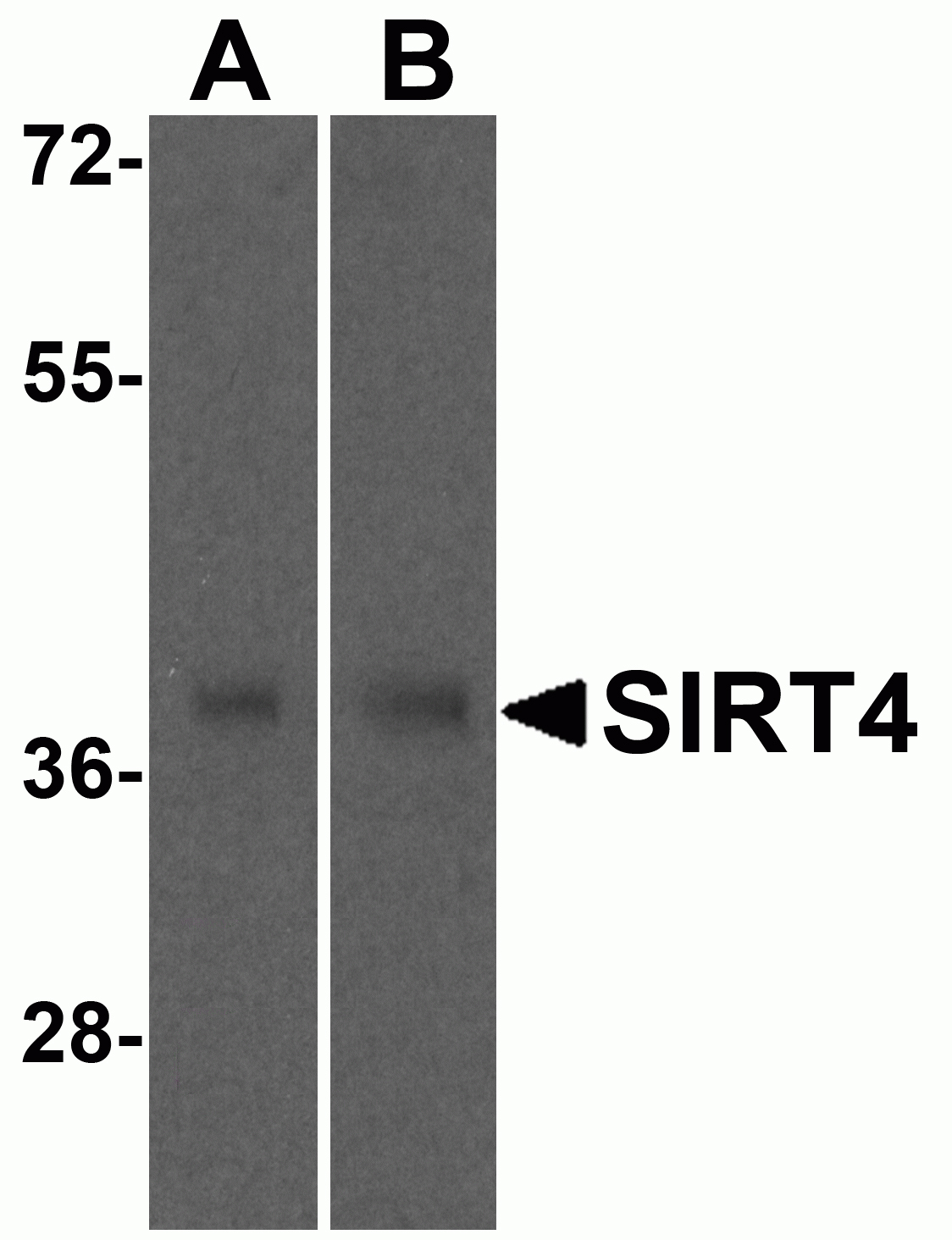 SIRT4 Antibody