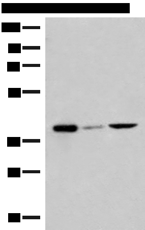 GP6 Antibody