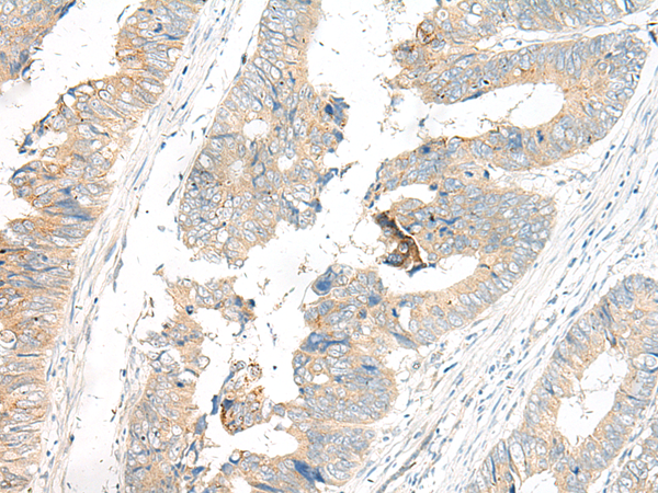 GP6 Antibody