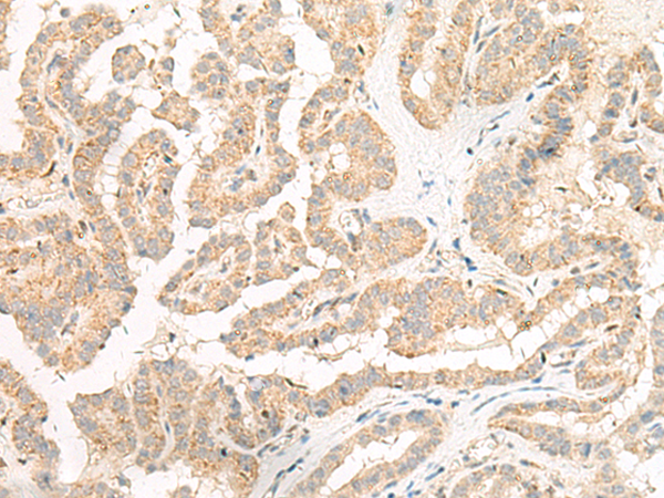 GP6 Antibody