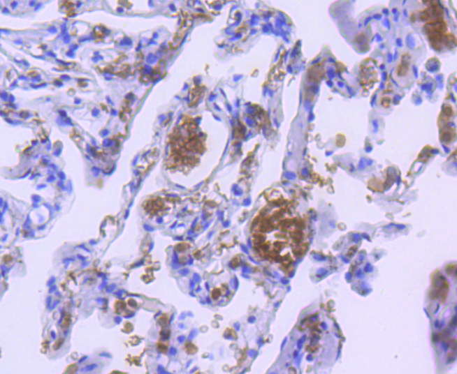 Hemoglobin subunit alpha Rabbit mAb