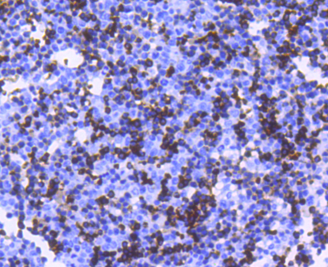 Hemoglobin subunit alpha Rabbit mAb