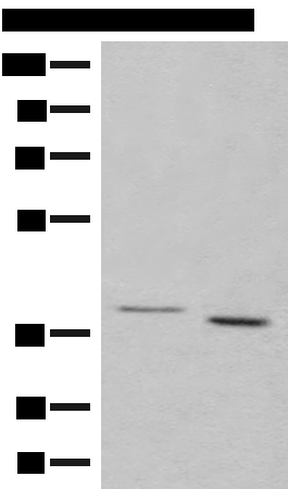 GALR1 Antibody