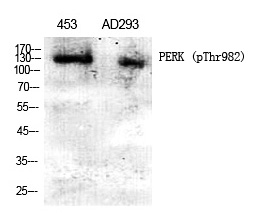 PERK (Phospho-Thr982) Polyclonal Antibody