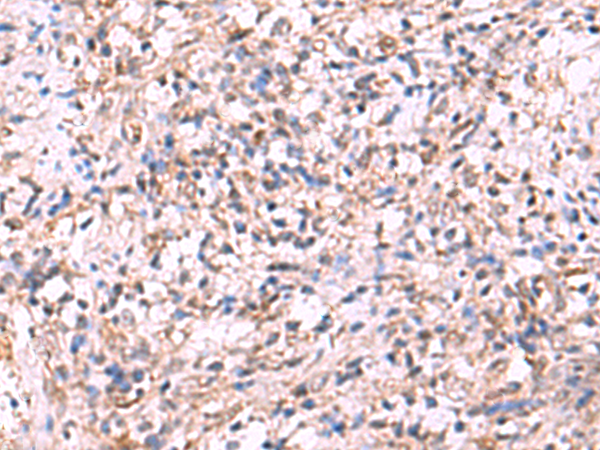 LMCD1 Antibody