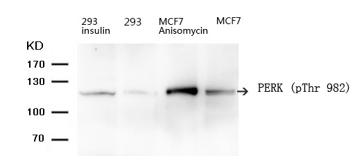 PERK (Phospho-Thr 982) Antibody