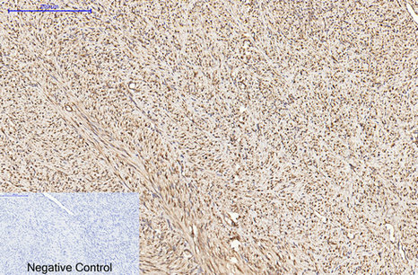 α-tubulin Mouse Monoclonal Antibody