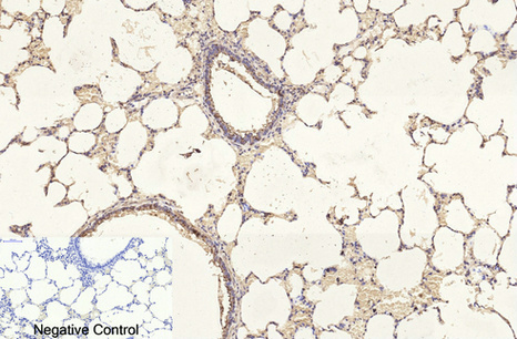 β I tubulin Mouse Monoclonal Antibody