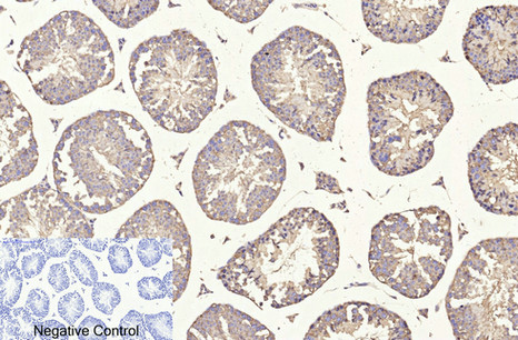 β I tubulin Mouse Monoclonal Antibody