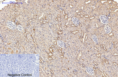 AMACR/P504S Mouse Monoclonal Antibody