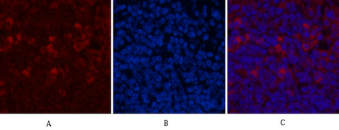 CD68 Mouse Monoclonal Antibody