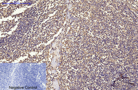 CD68 Mouse Monoclonal Antibody