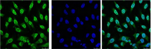 p53 Mouse Monoclonal Antibody