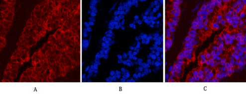 CK16 Mouse Monoclonal Antibody