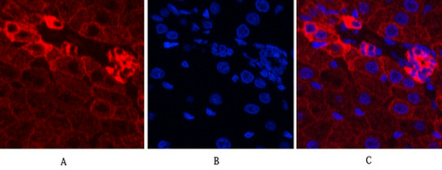 CK16 Mouse Monoclonal Antibody