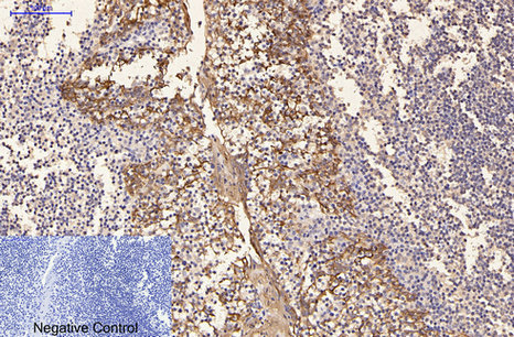 CK16 Mouse Monoclonal Antibody