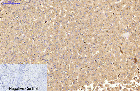 Carcinoembryonic Antigen(CEA) Mouse Monoclonal Antibody